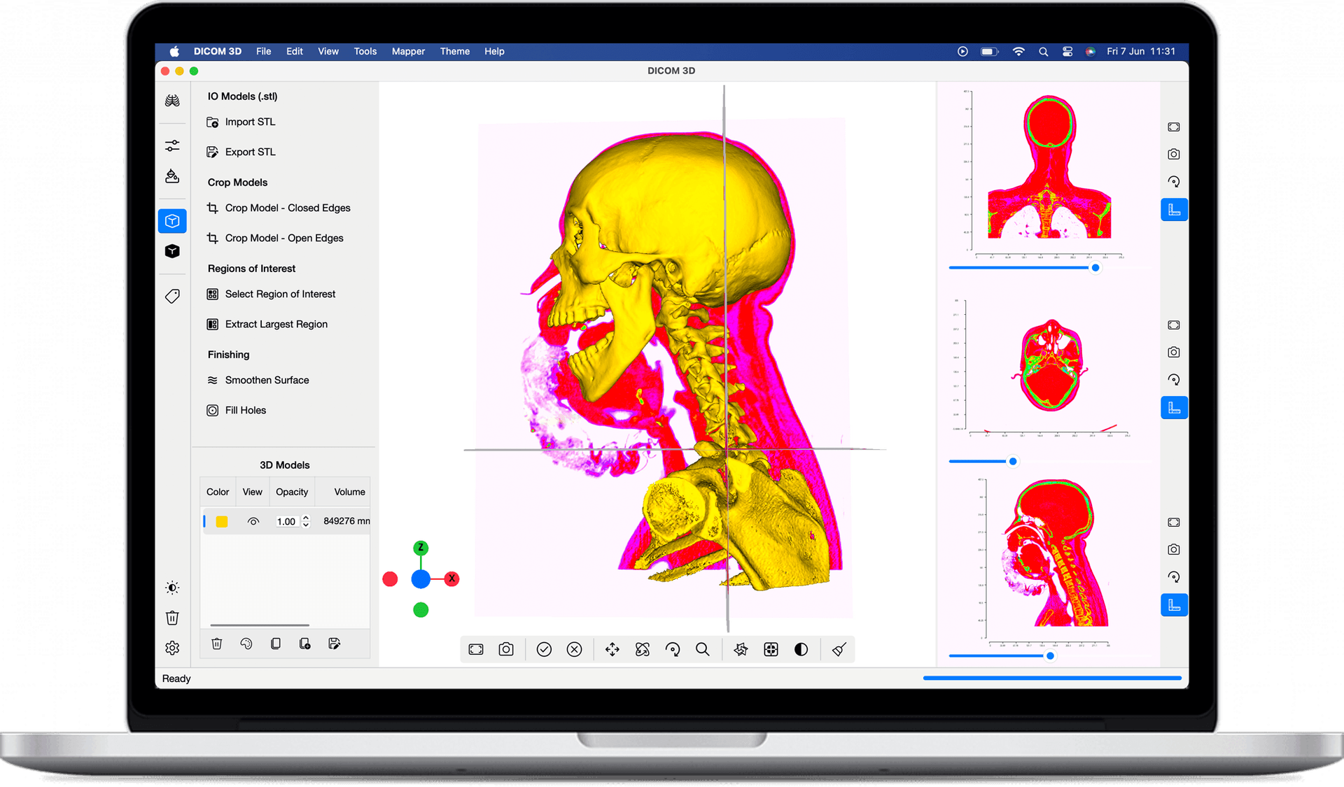 DICOM 3D