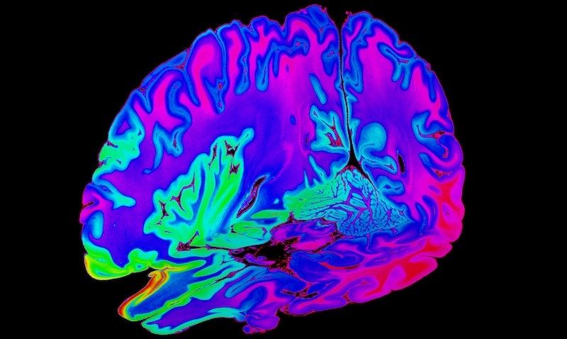 3D Slices - DICOM Studio