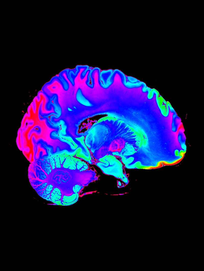 Vista: 2D DICOM View