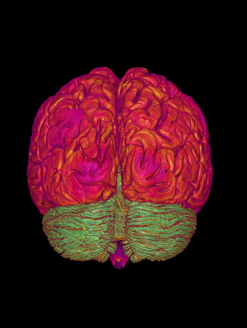 Vista: 3D Volume View