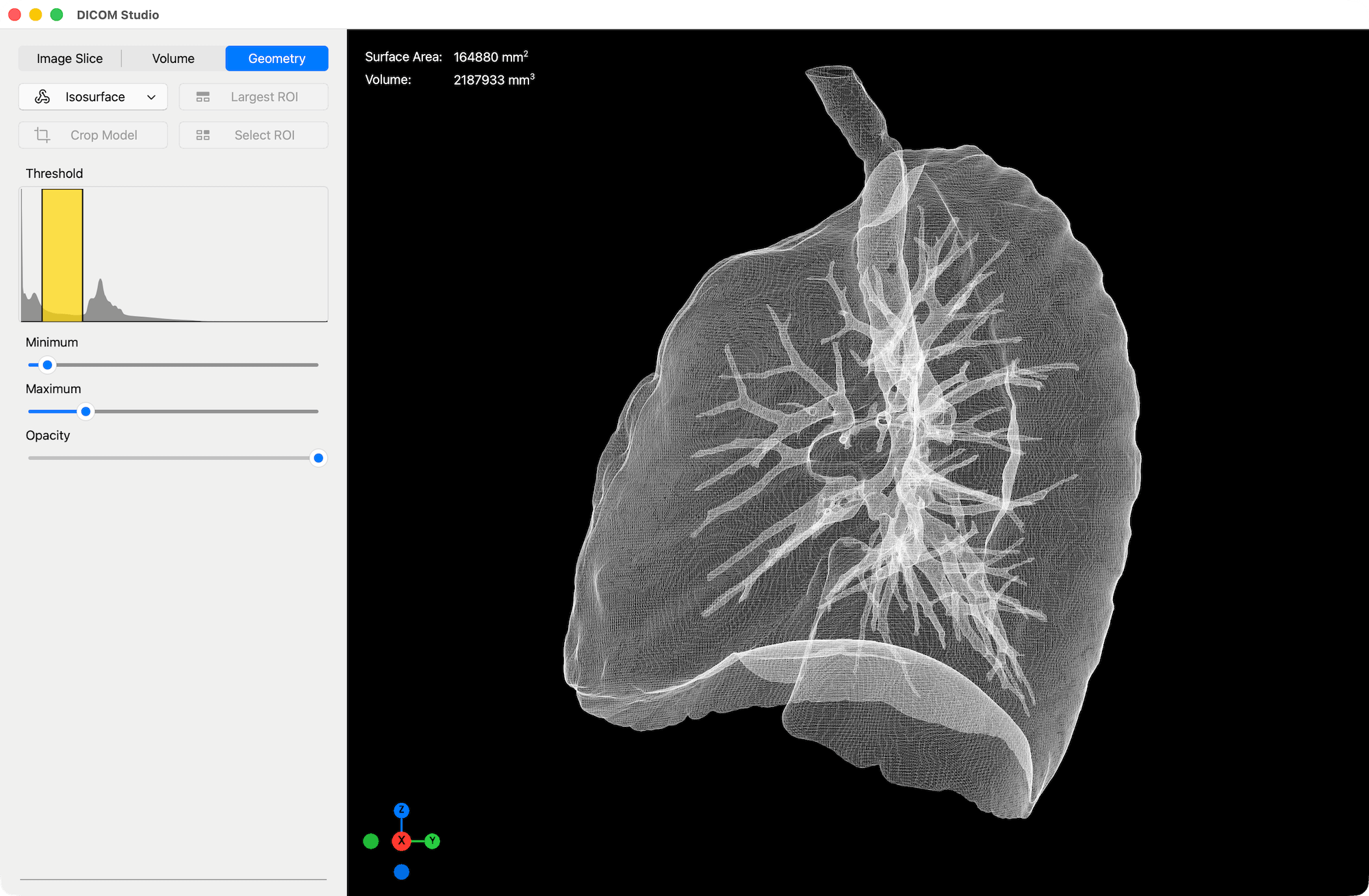 Isosurface Wireframe - DICOM Studio