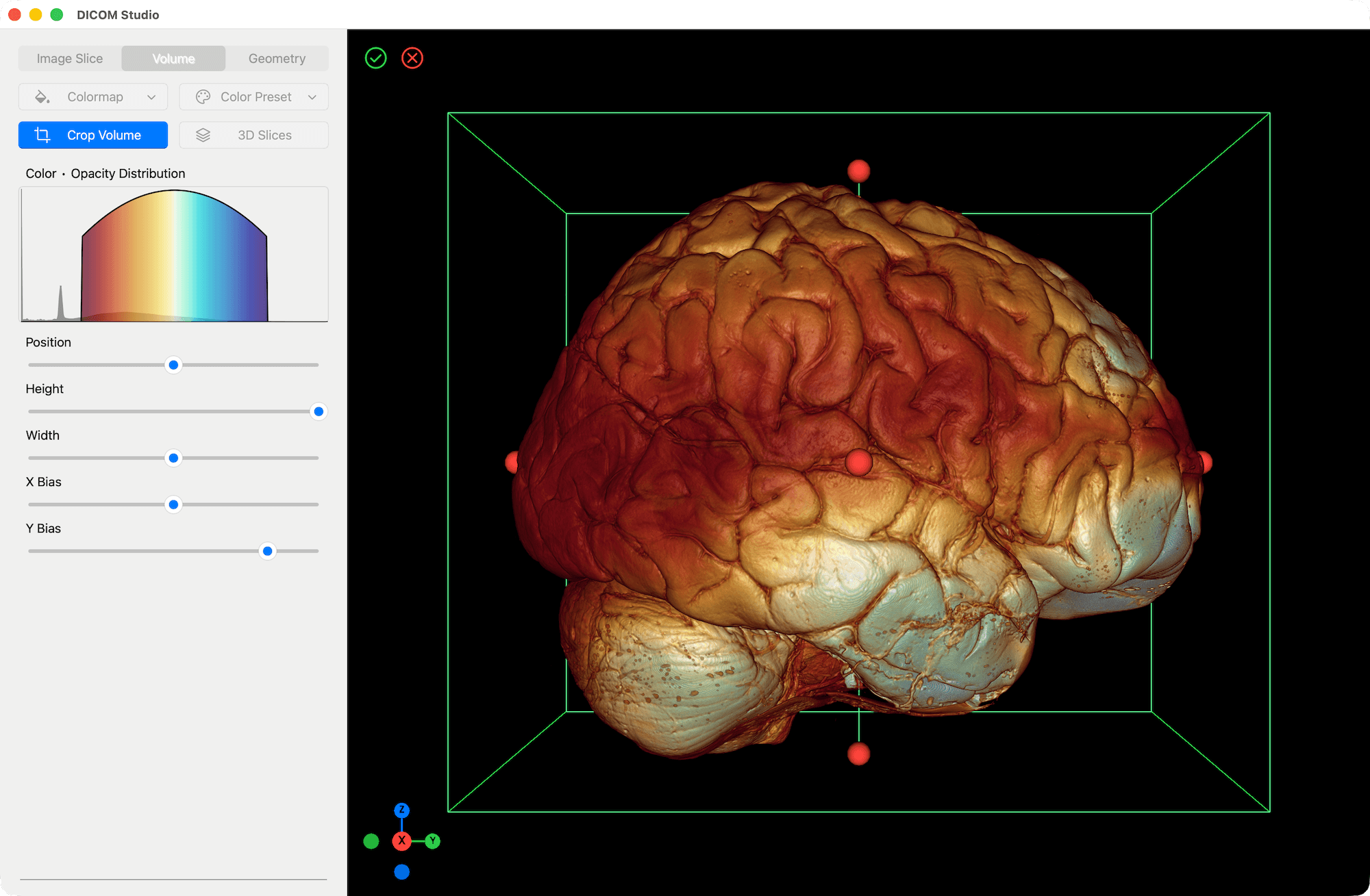 Volume Crop Before - DICOM Studio