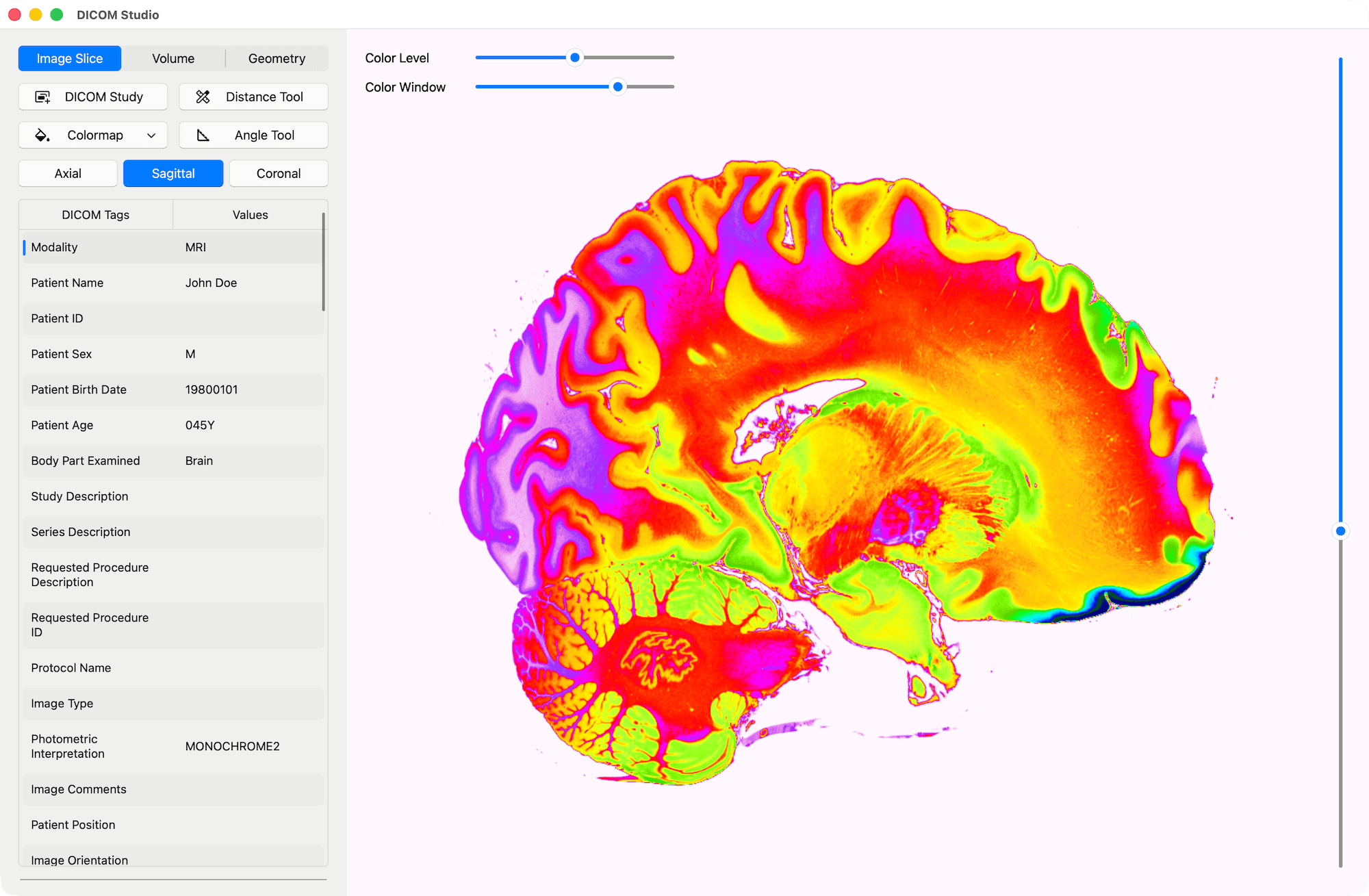 Sagittal Slice with Colormap - DICOM Studio