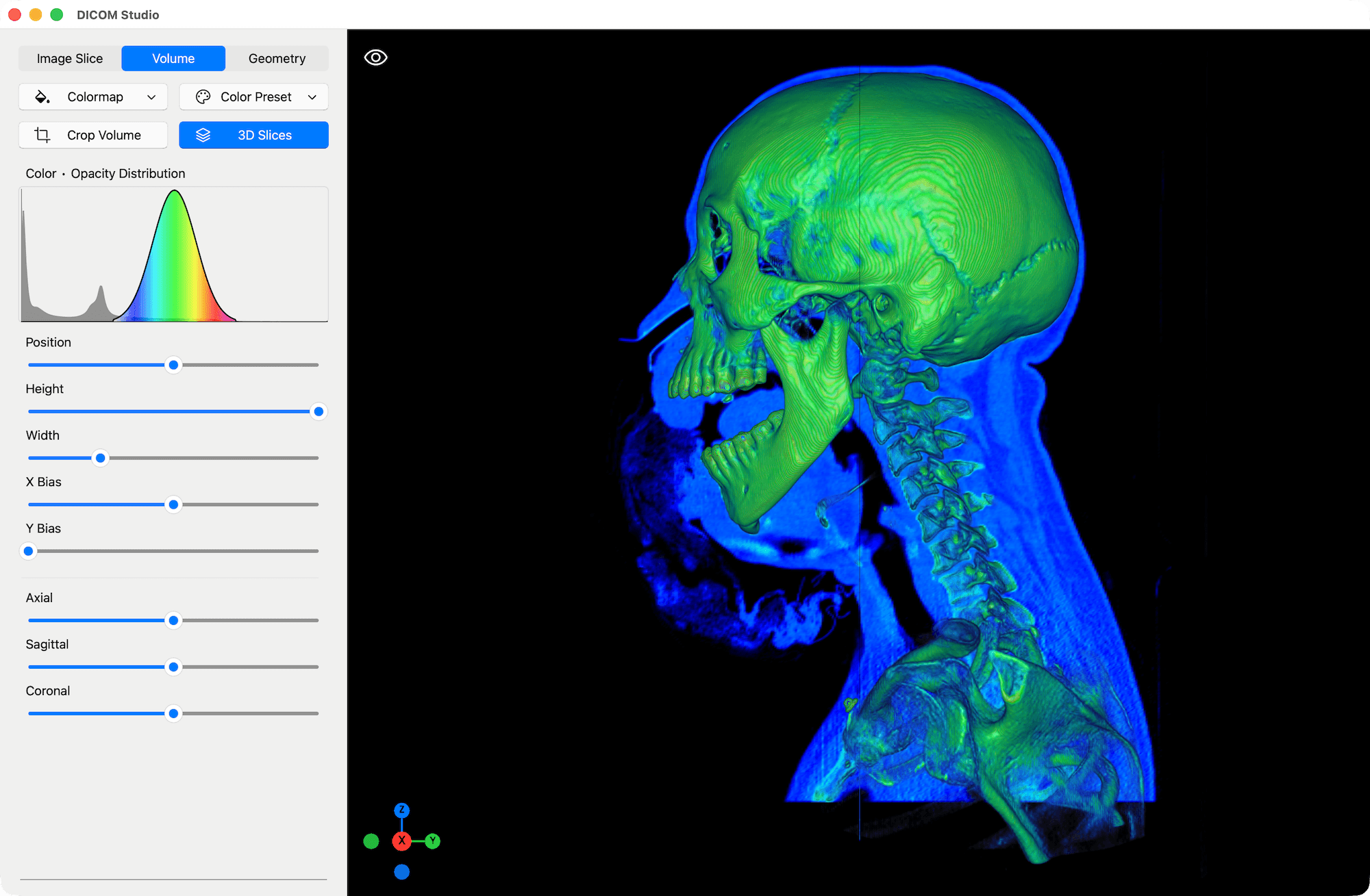 3D Slices - DICOM Studio