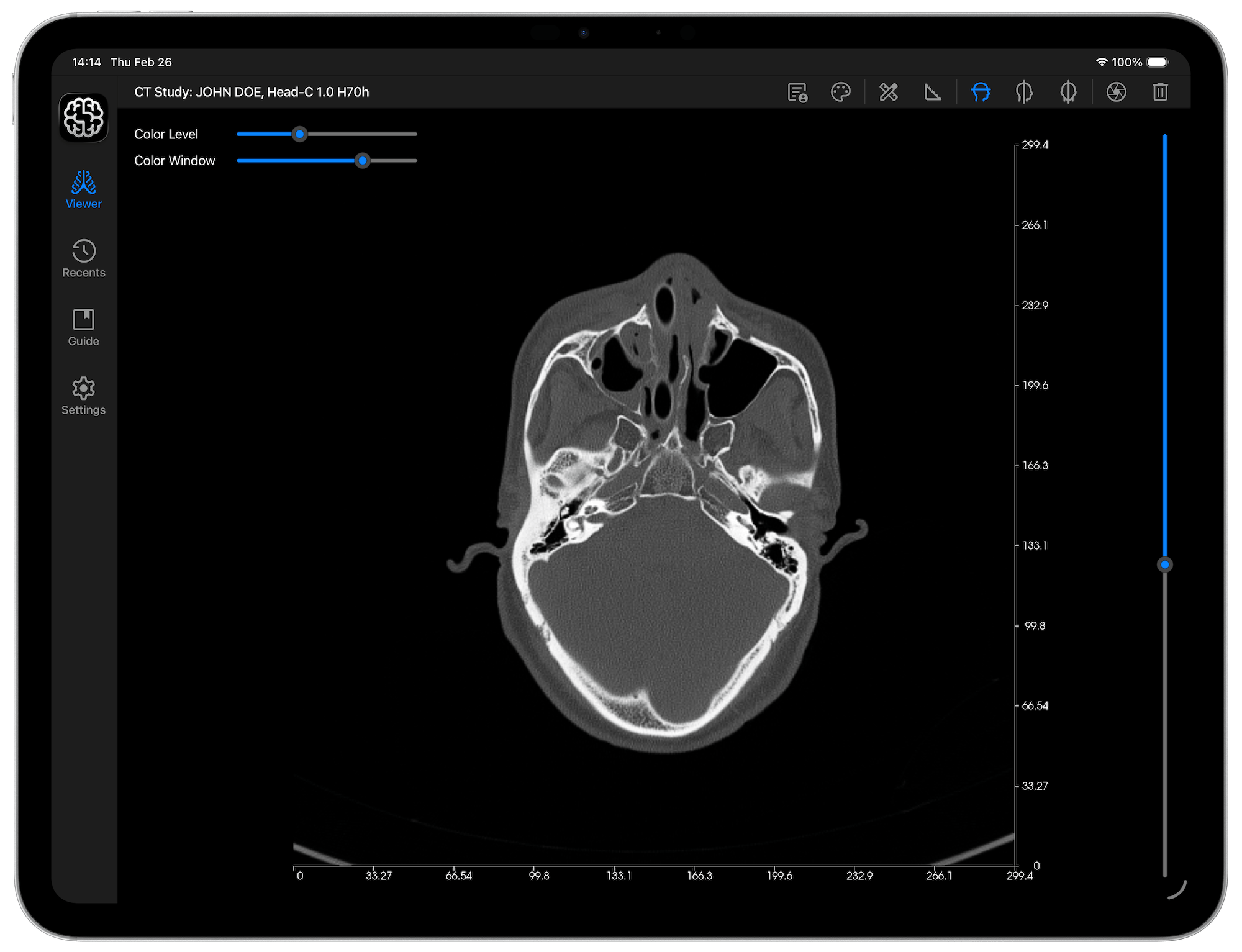 DICOM Studio Go on iPad - Select DICOM Folder (Landscape View)