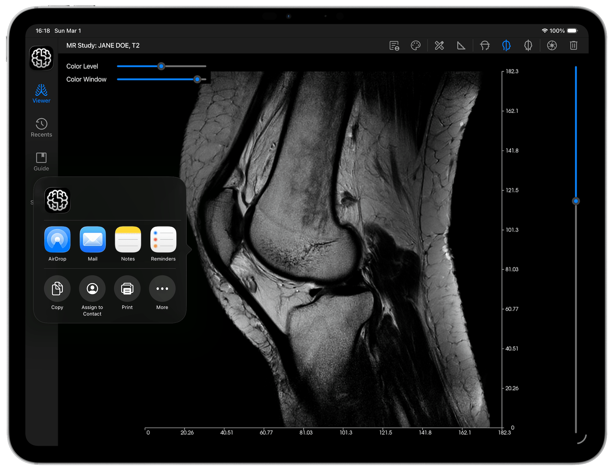 DICOM Studio Go on iPad - Share Screenshot