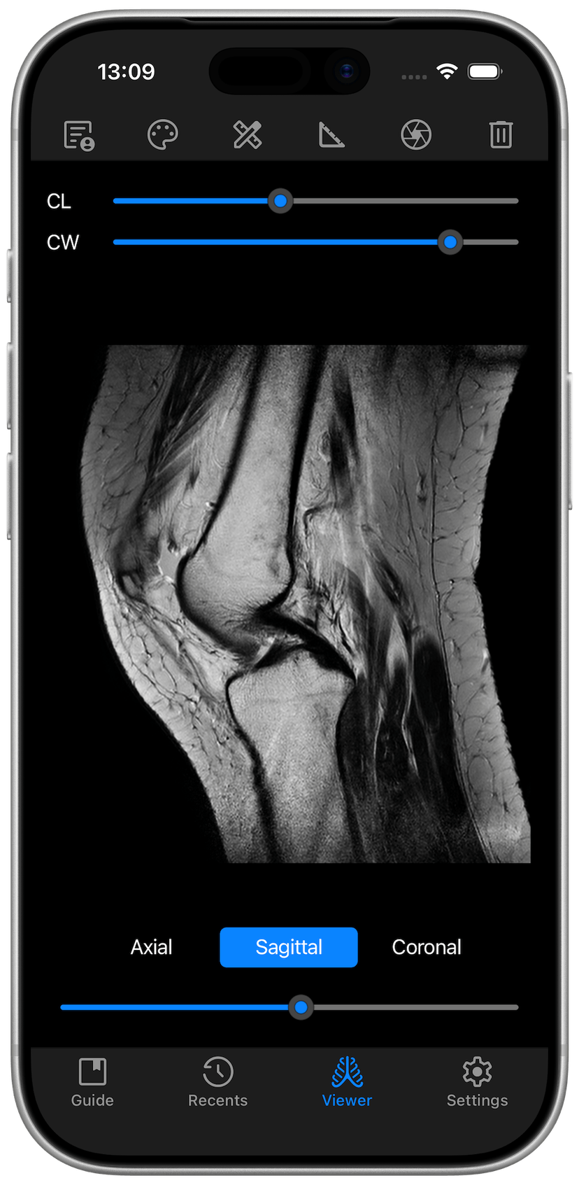 DICOM Studio Go on iPhone - Viewer