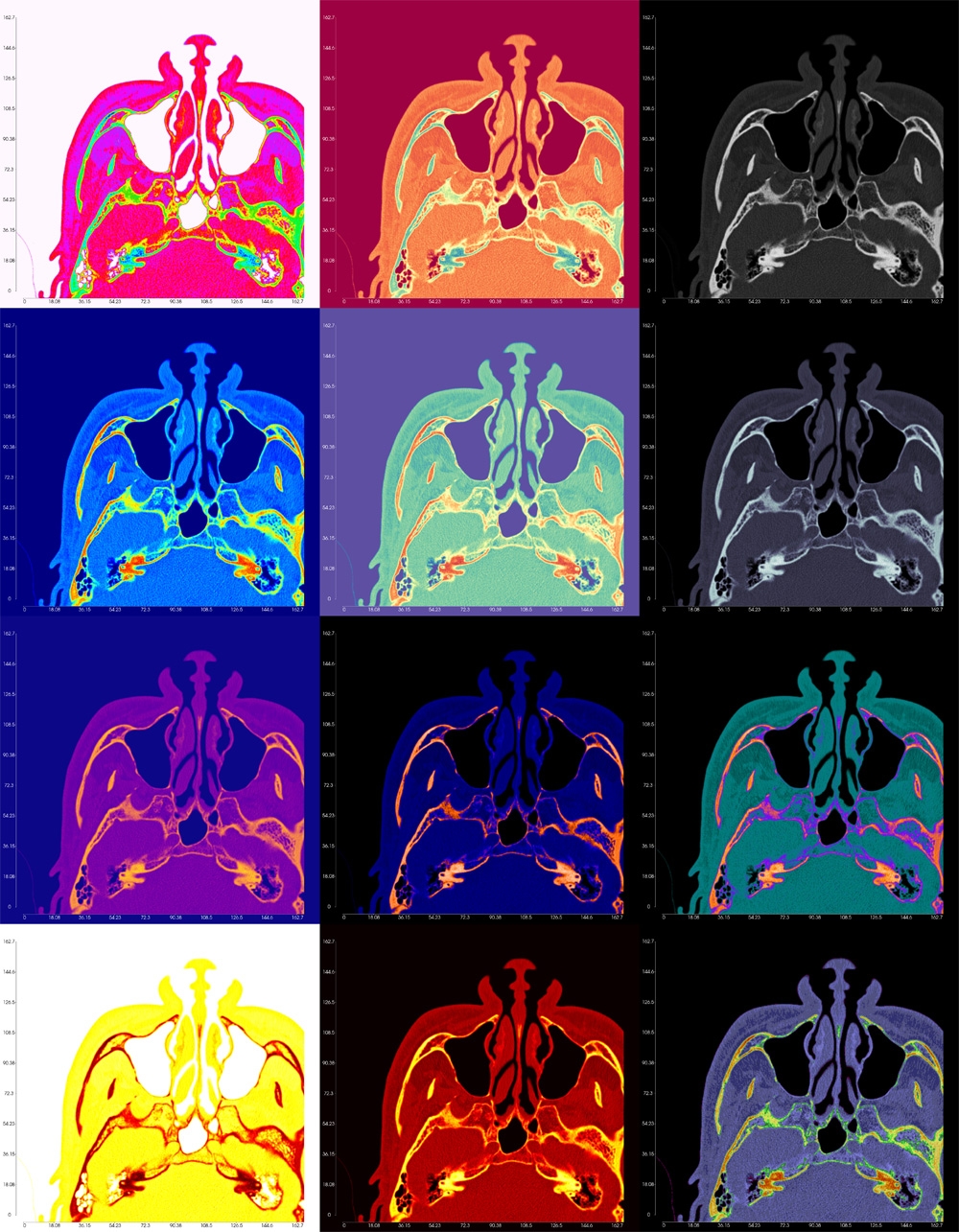 DICOM Slices with Colormap Options Applied