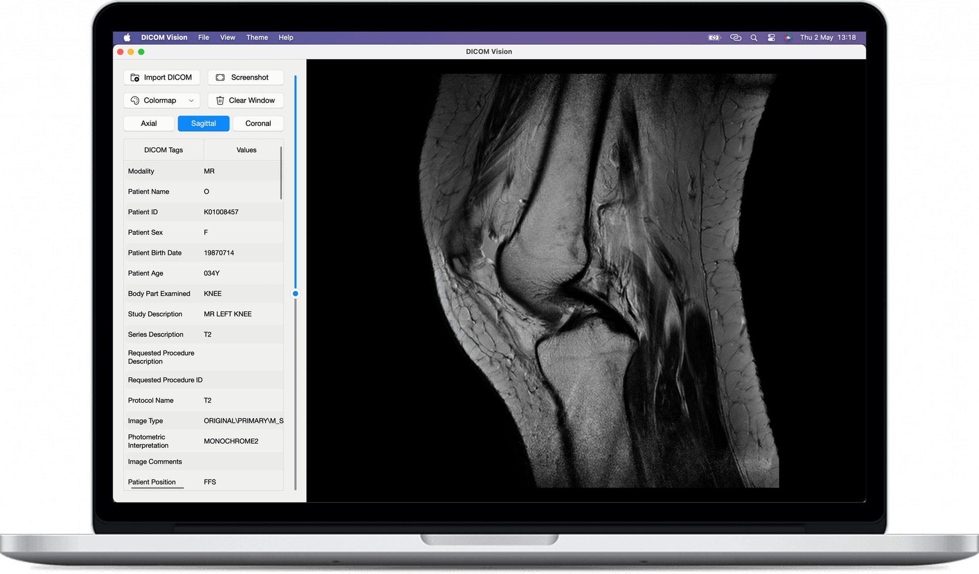 DICOM Vision