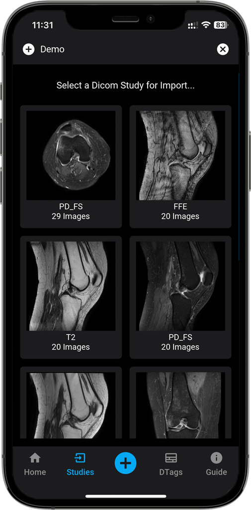 DICOM Vision Mobile