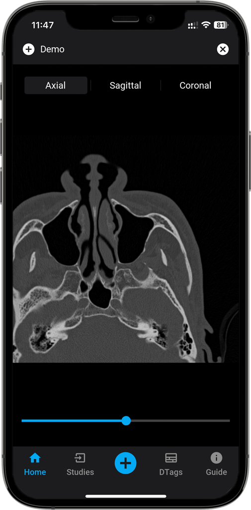 DICOM Vision Mobile