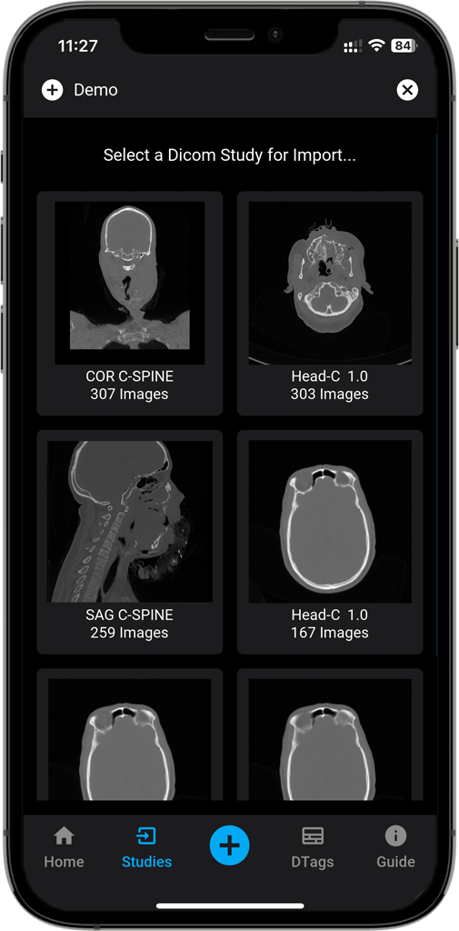 DICOM Vision Mobile