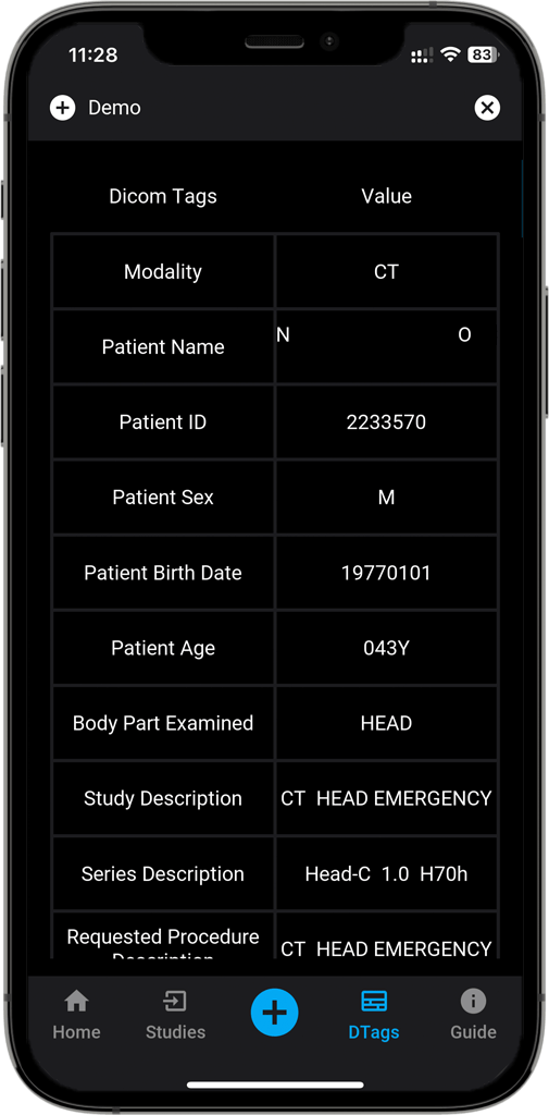 DICOM Vision Mobile