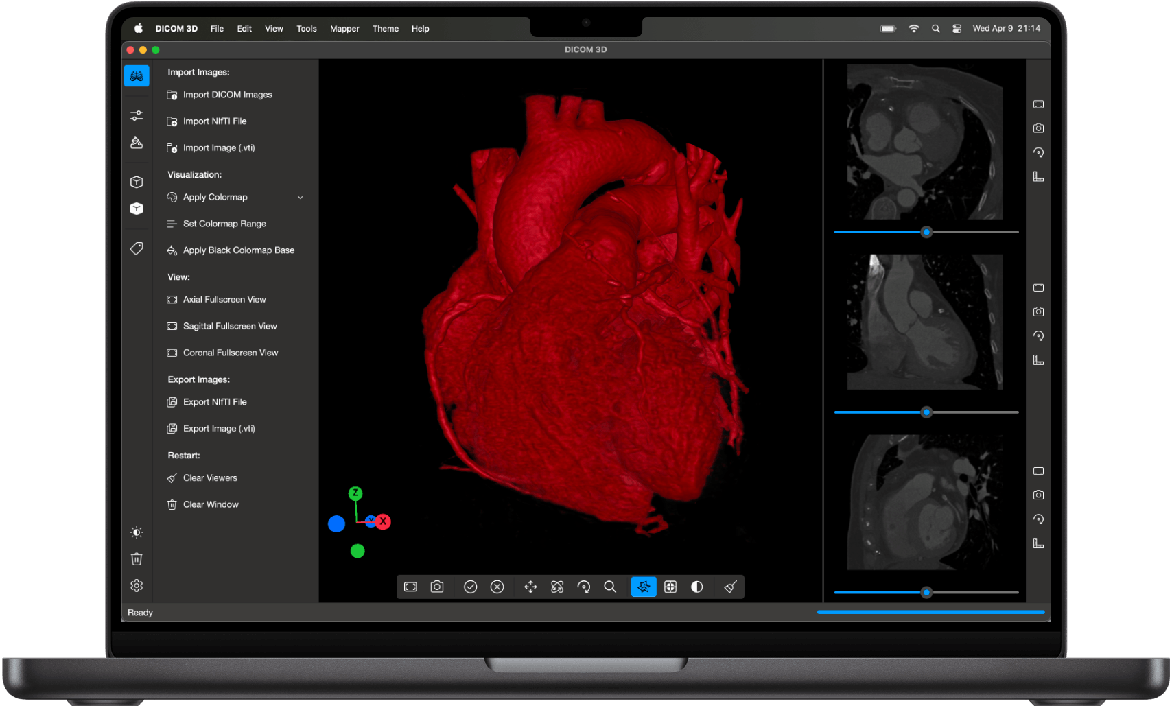 DICOM Vision