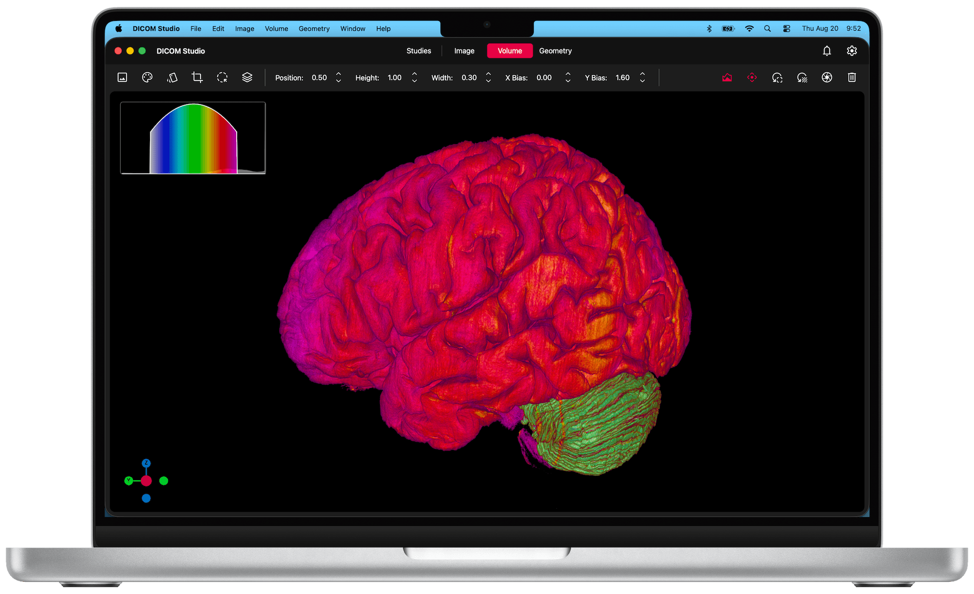 DICOM Studio on Mac