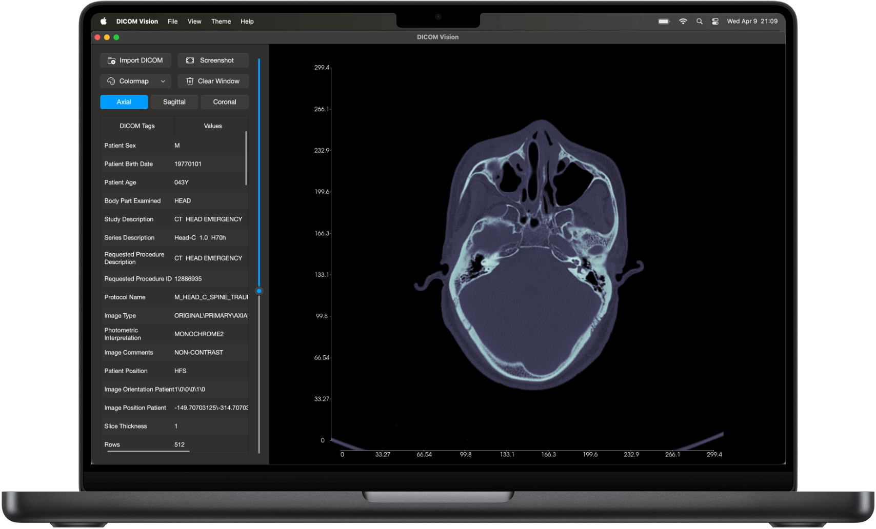 DICOM Vision