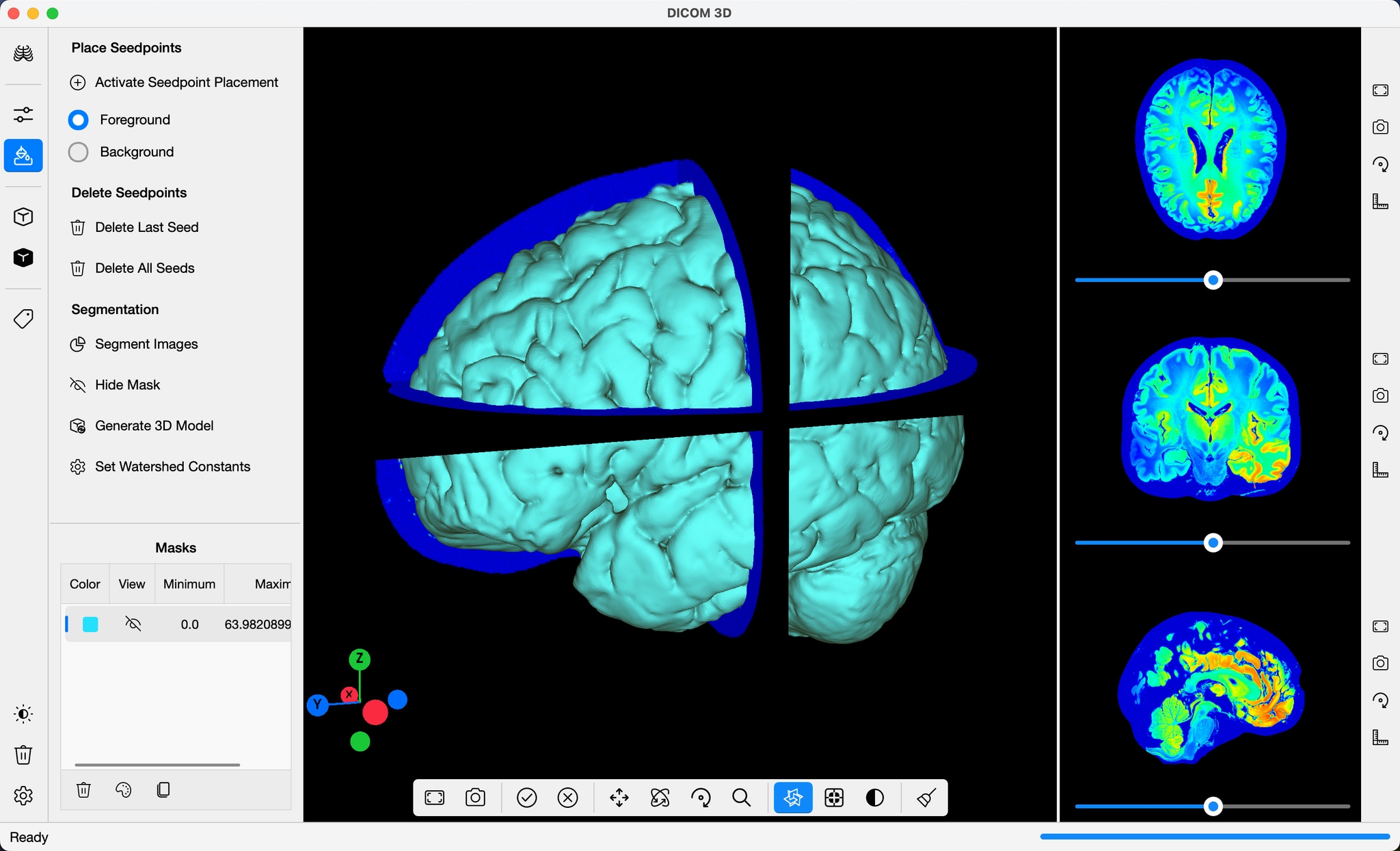 DICOM 3D