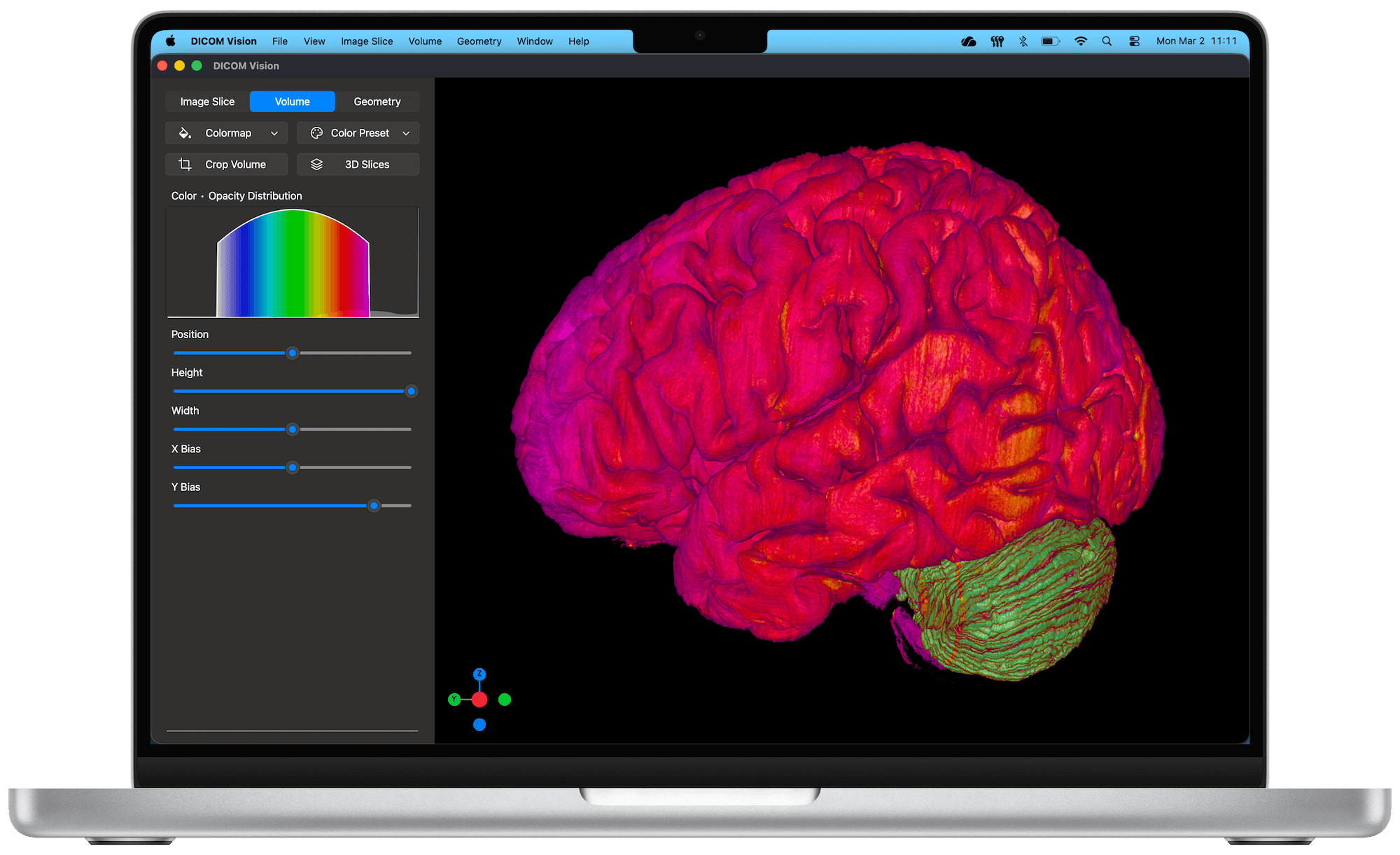 DICOM Vision 2 on Mac