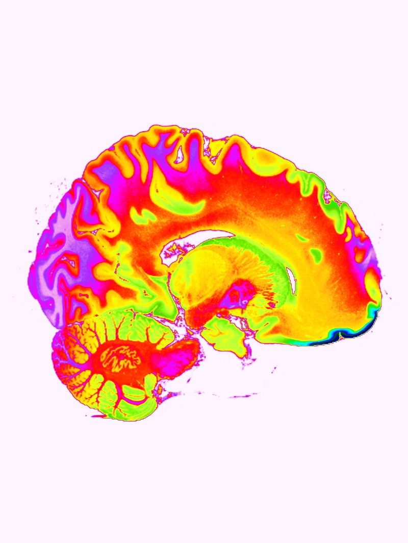 Vista: 2D DICOM View
