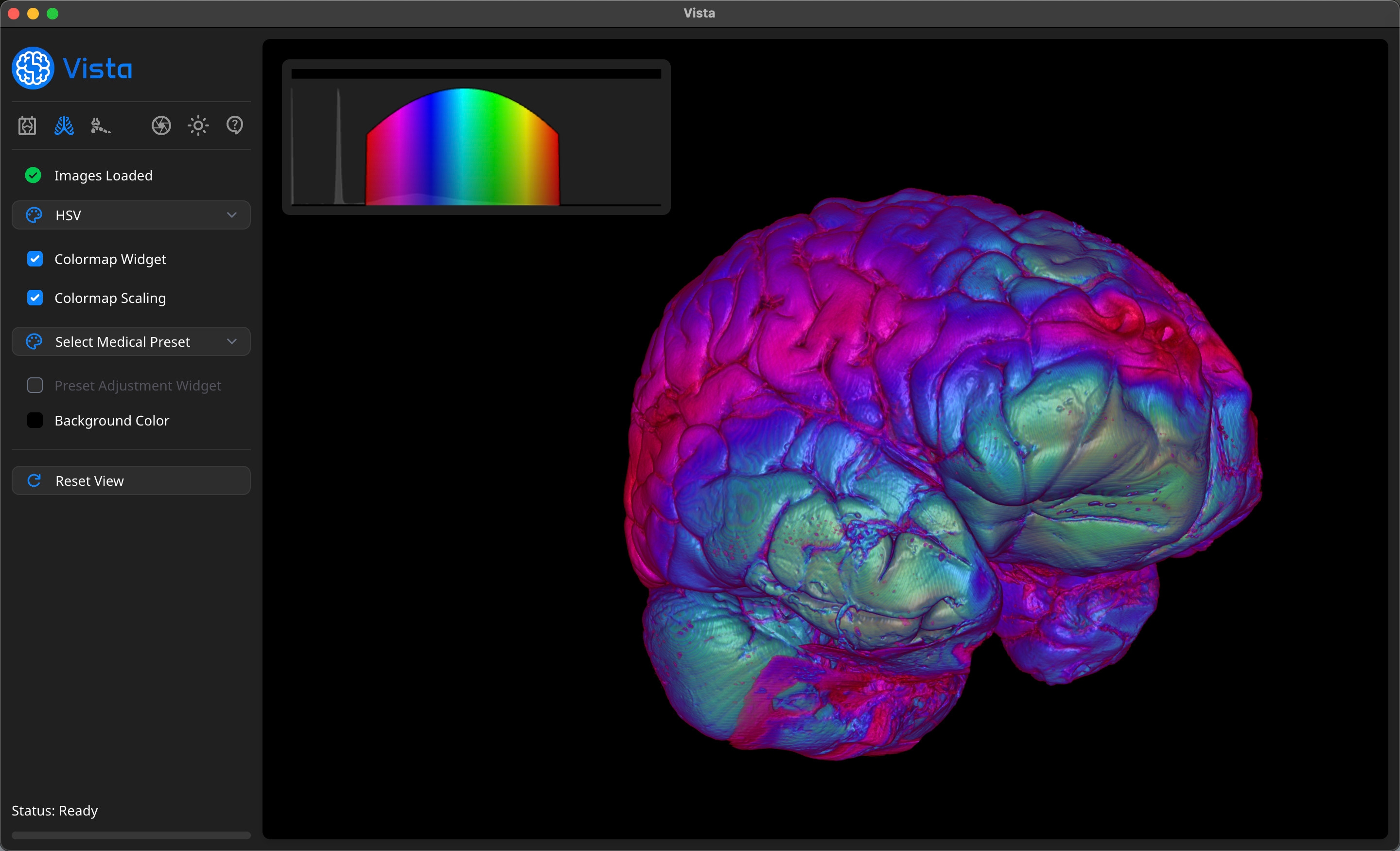 Vista - Volume Viewer Profile