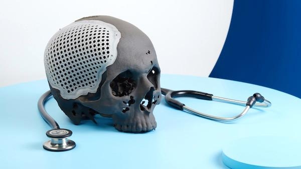 Cranial Fixture