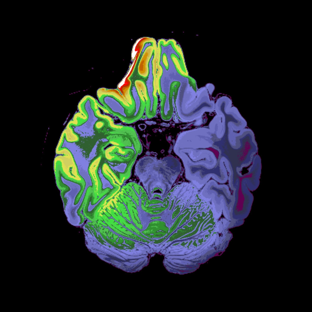 Different Colormap Applied
