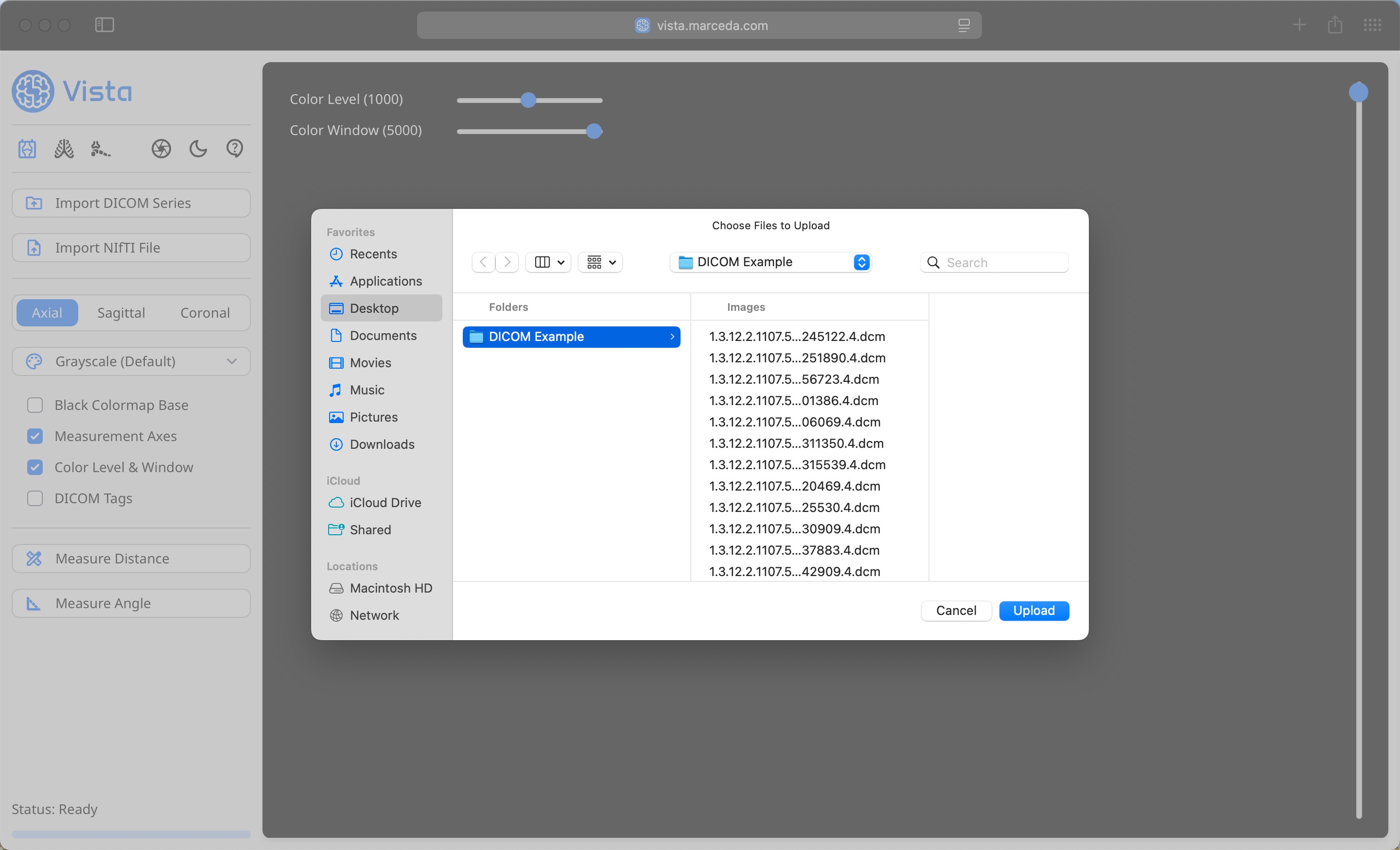 DICOM File Selection in Vista
