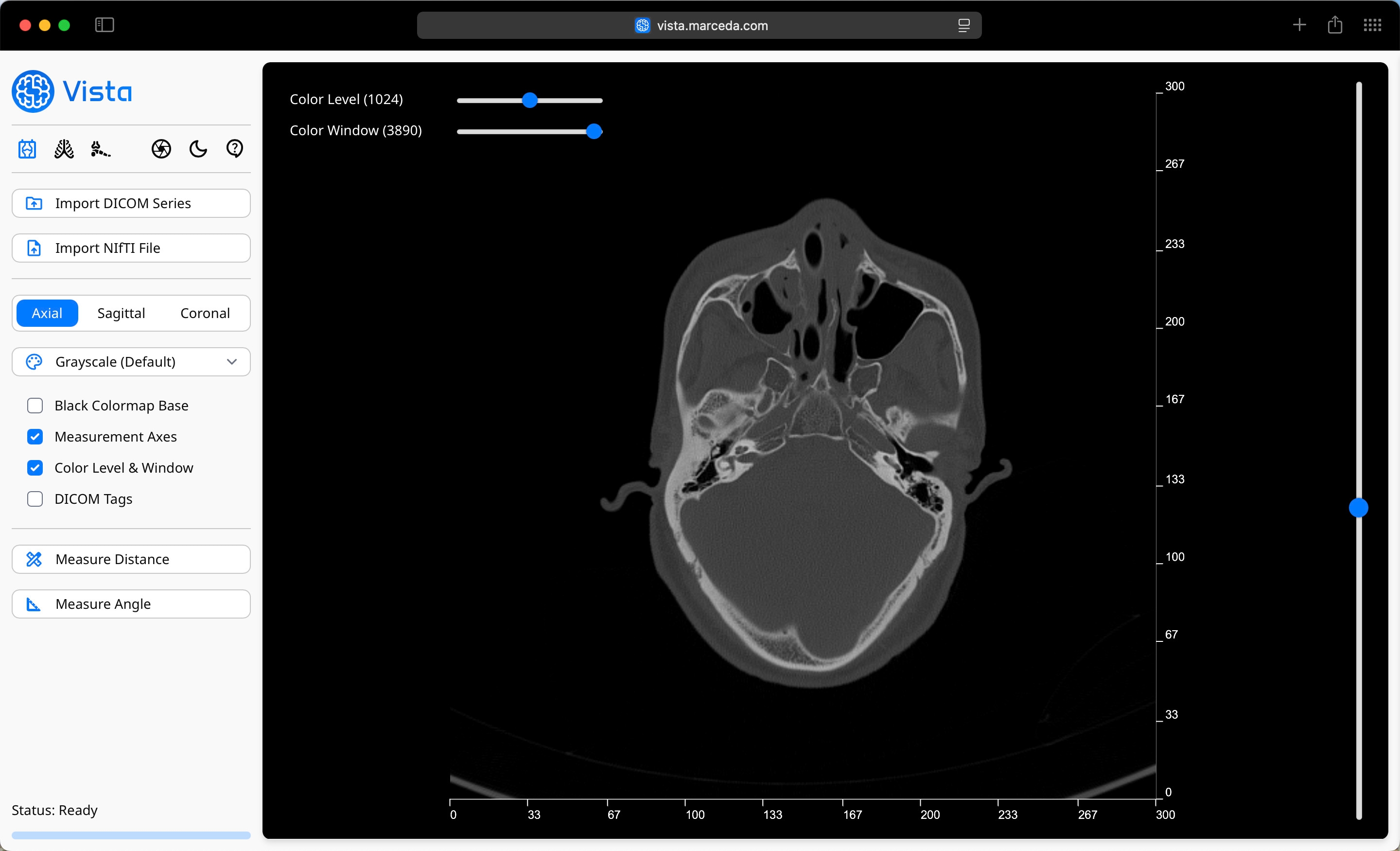 DICOM Image Import in Vista