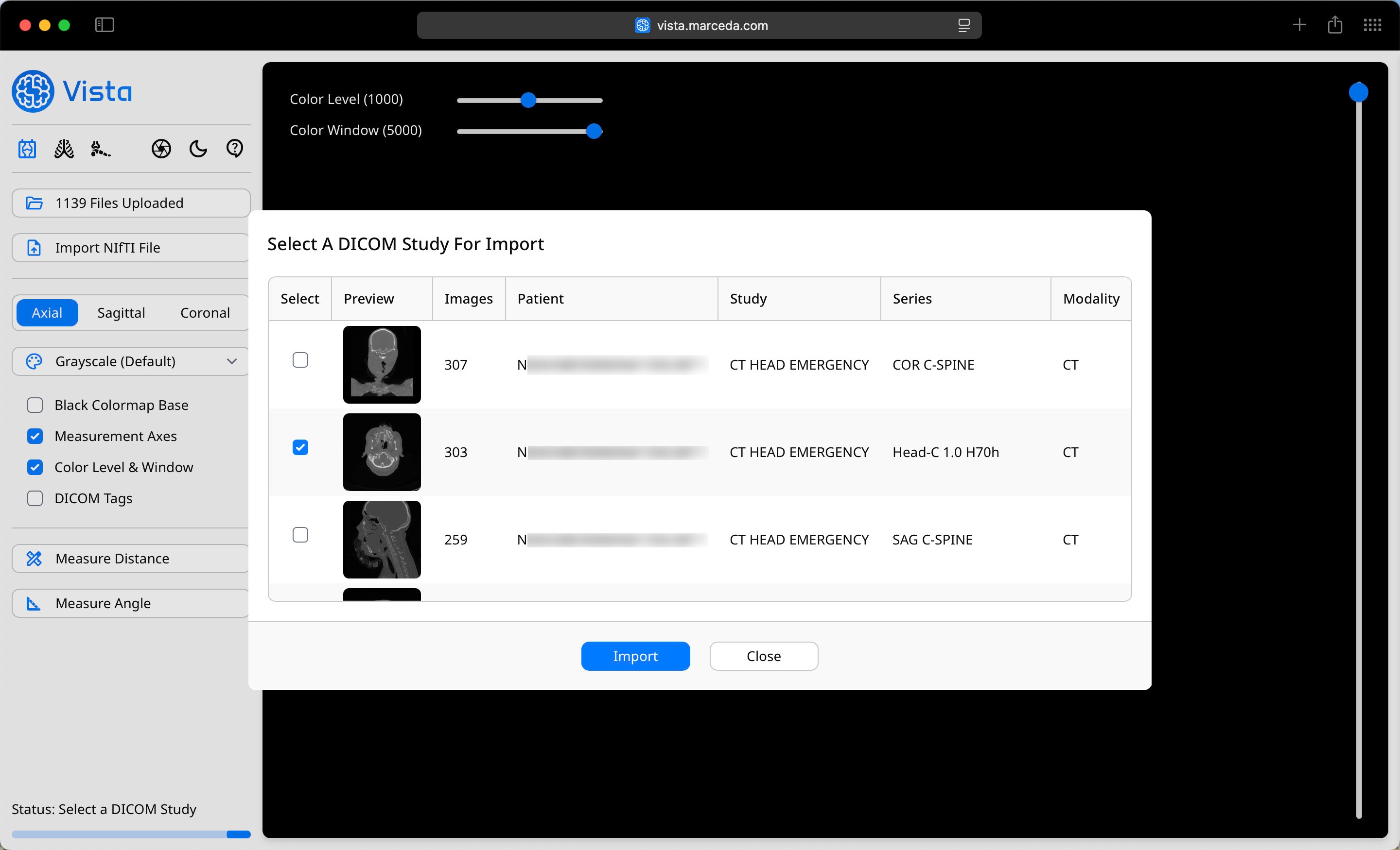 DICOM Series Selection in Vista