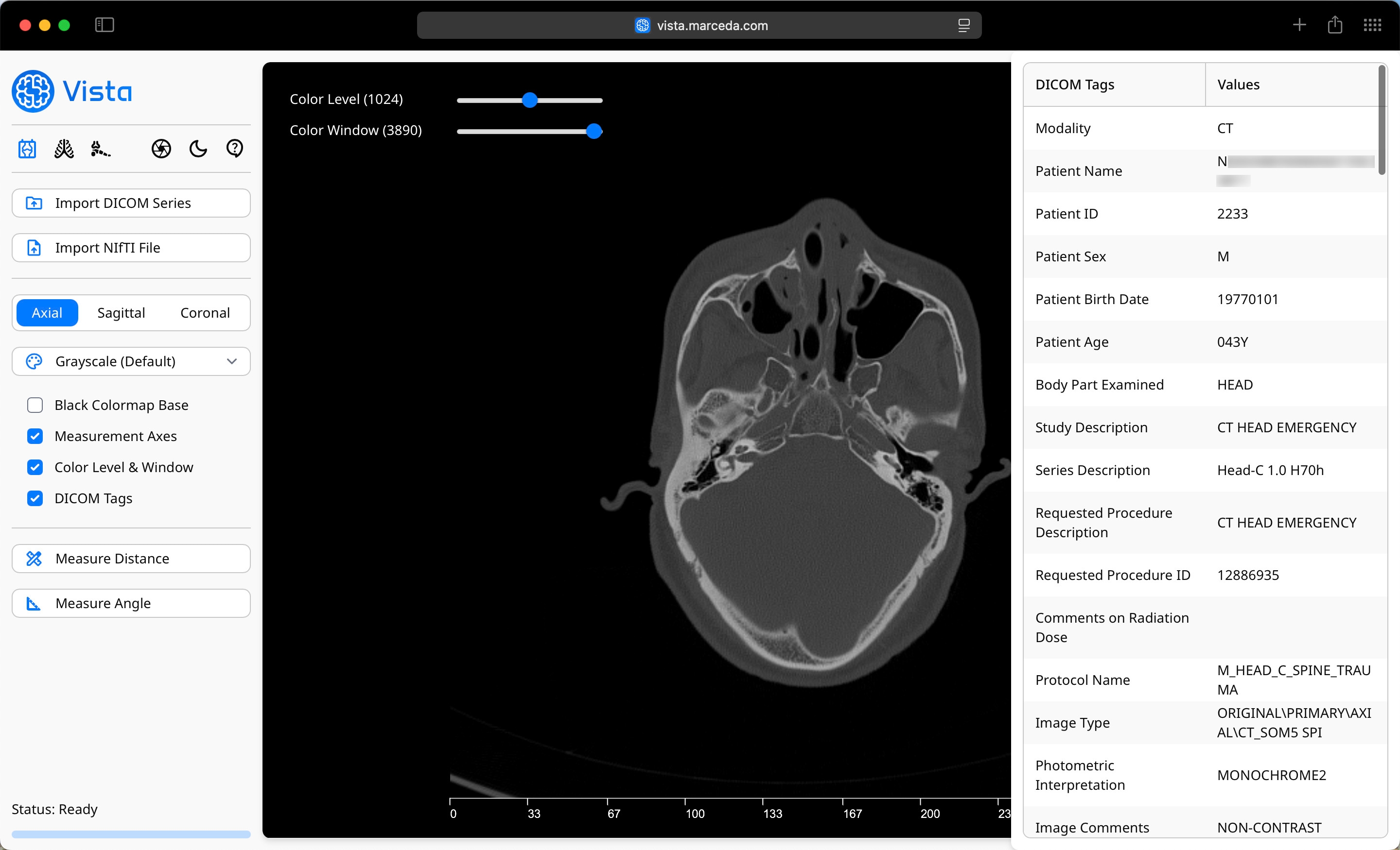 DICOM Tags Window in Vista