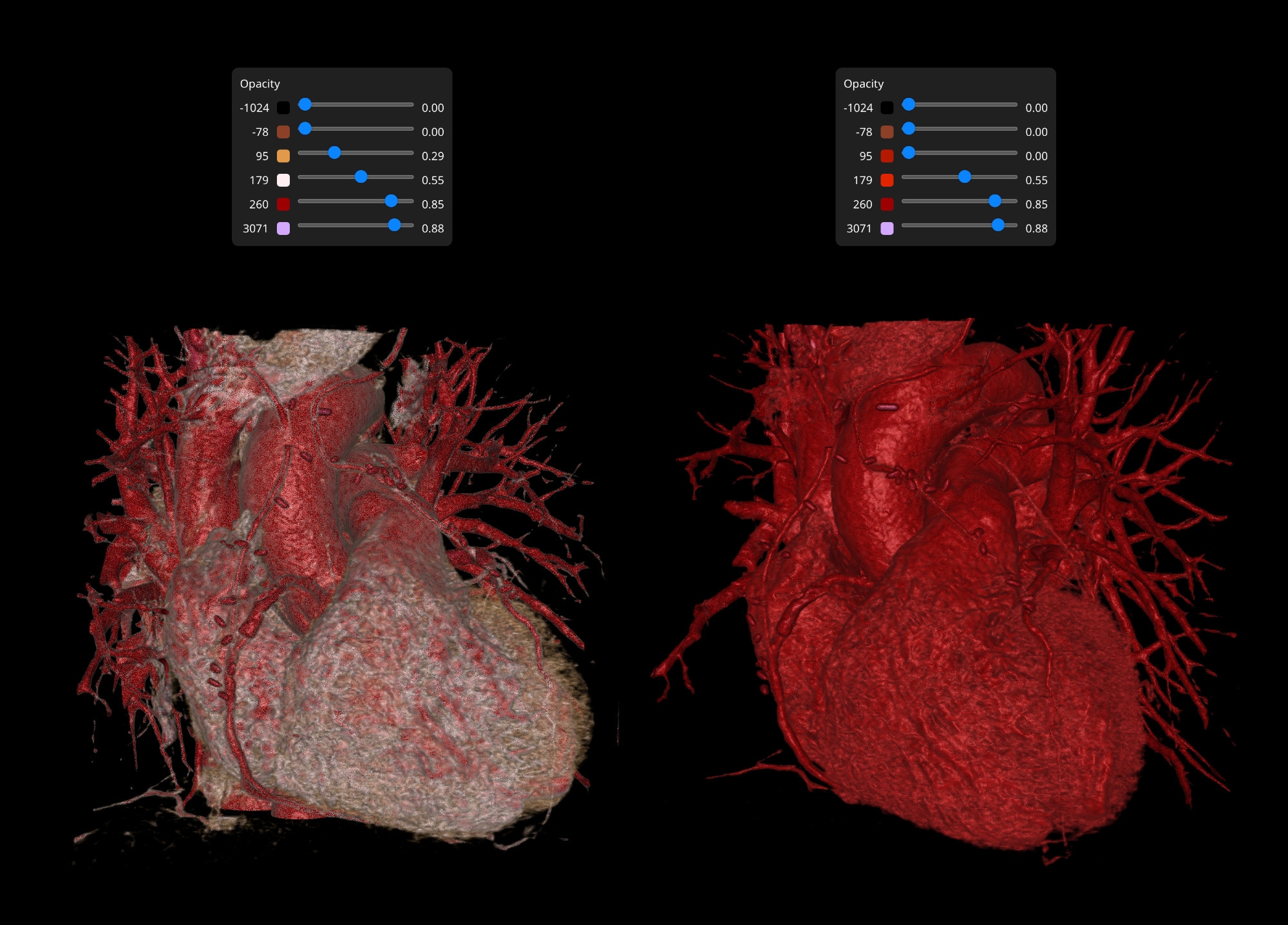 Different opacities applied to a Spleen Volume in Vista