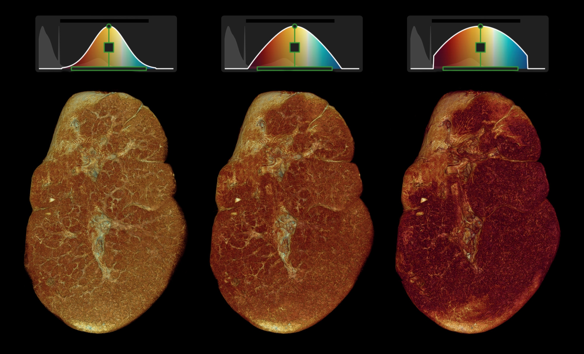 Different opacities applied to a Spleen Volume in Vista