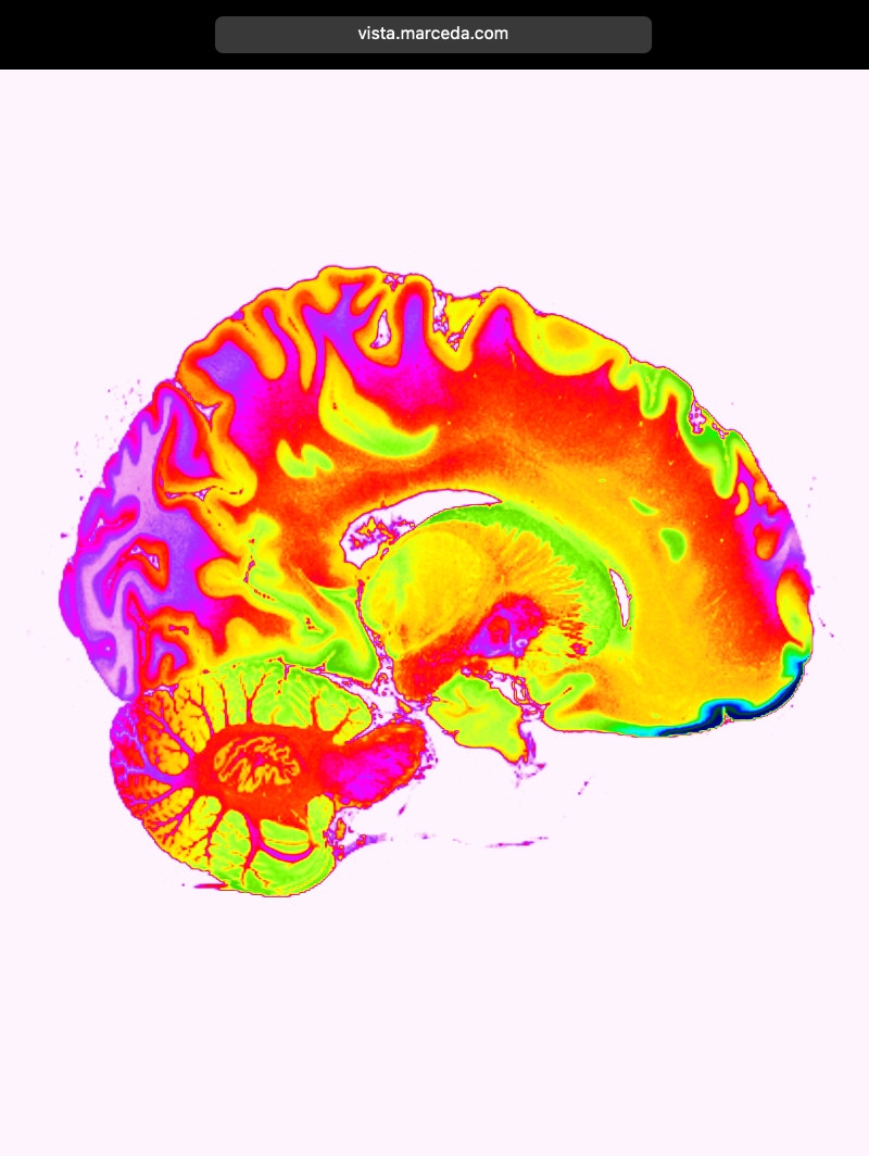 Vista: 2D DICOM View