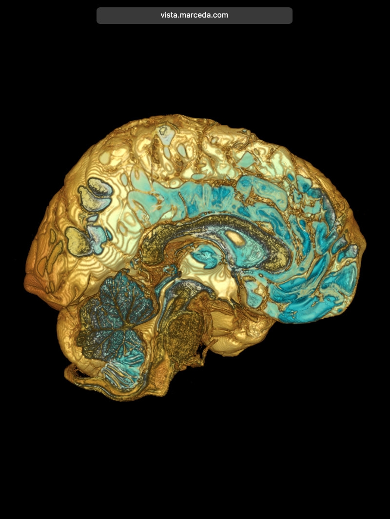 Vista: 3D Volume View