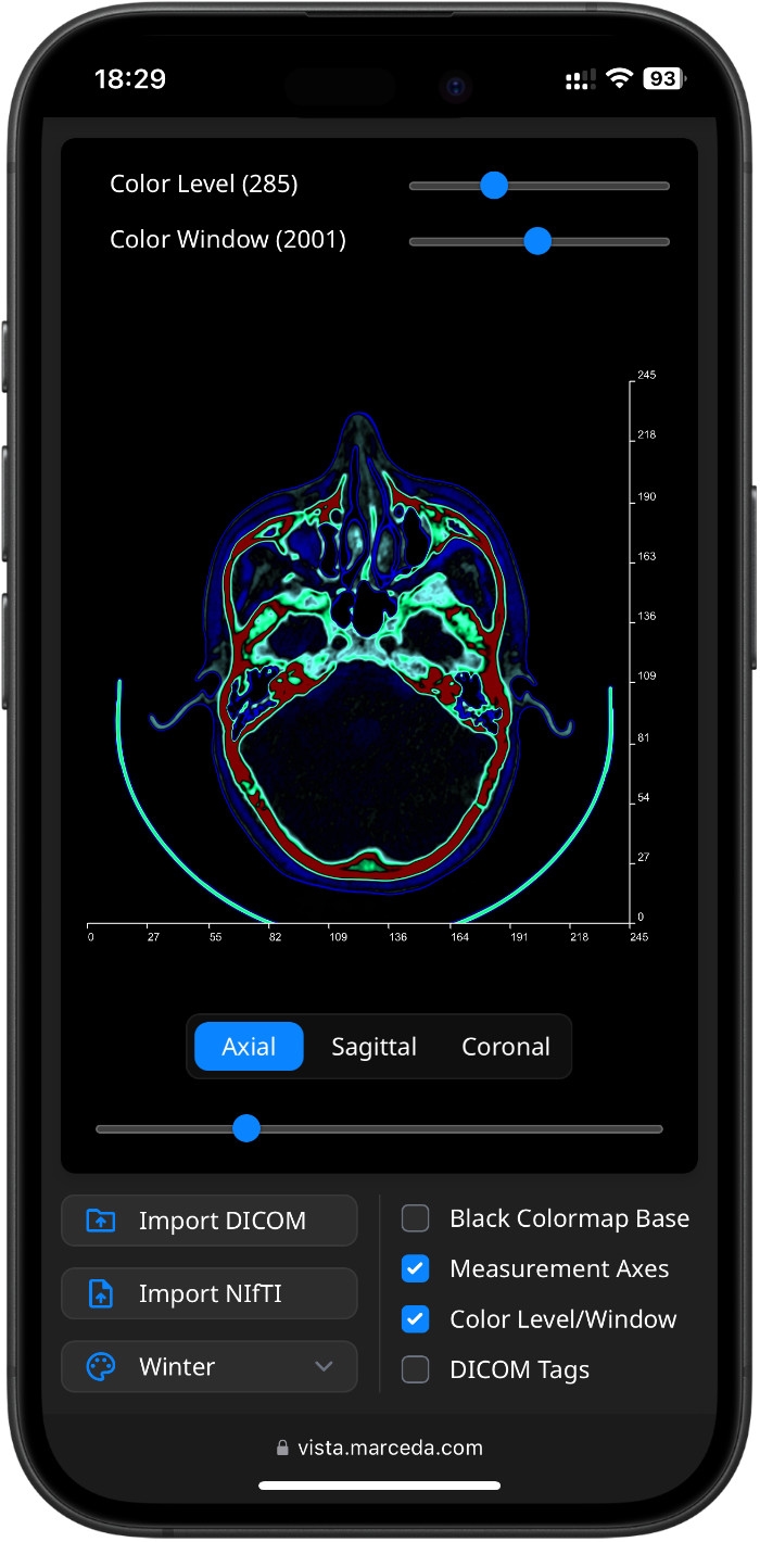 DICOM Images with Colormap Applied in Vista on iPhone