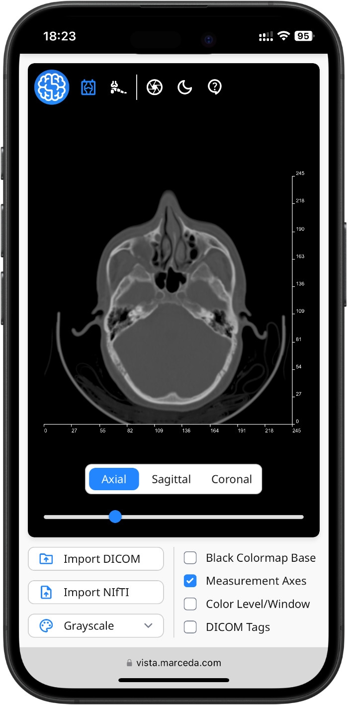 DICOM Image in Vista on iPhone
