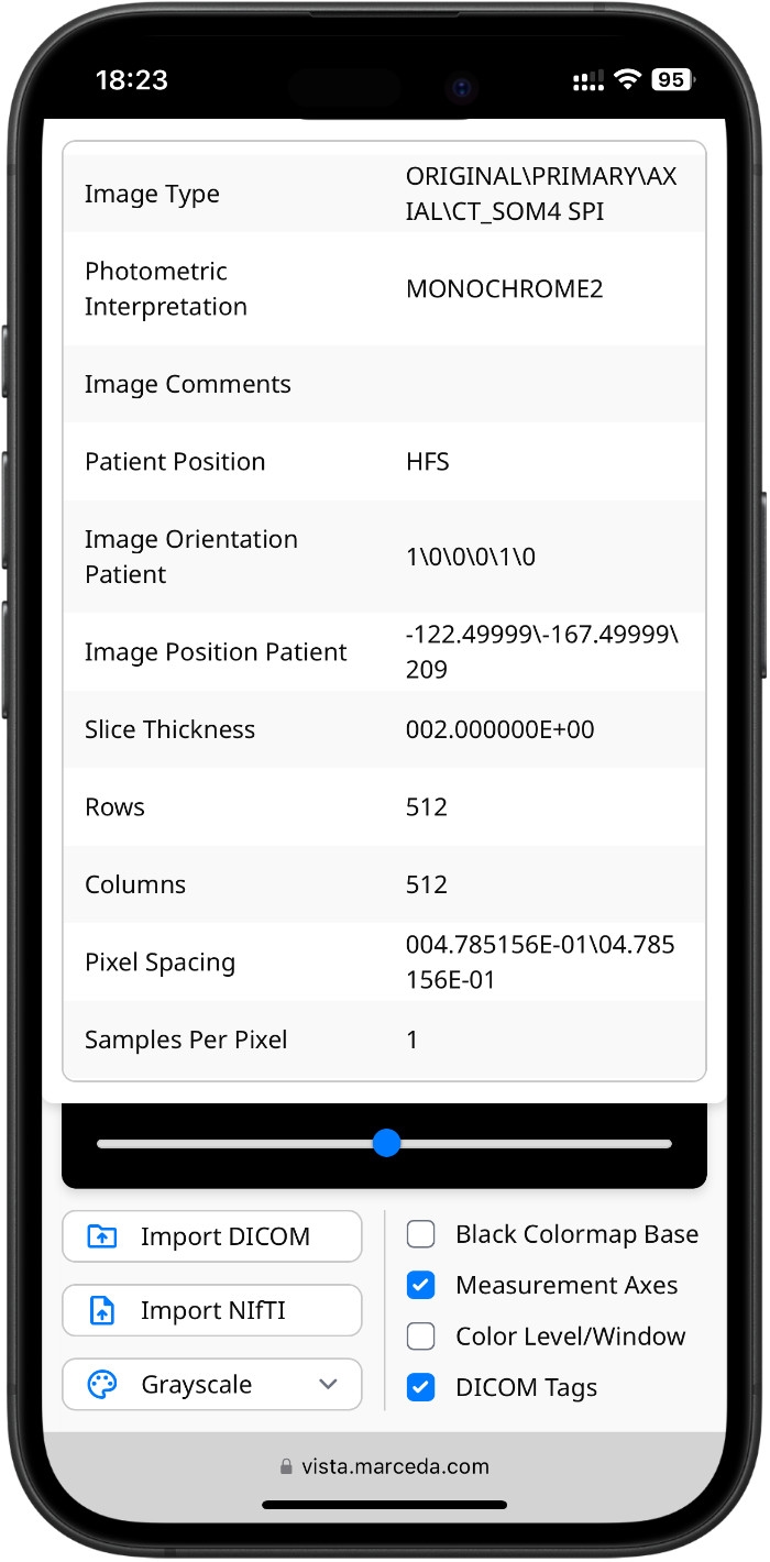 DICOM Tags in Vista on iPhone
