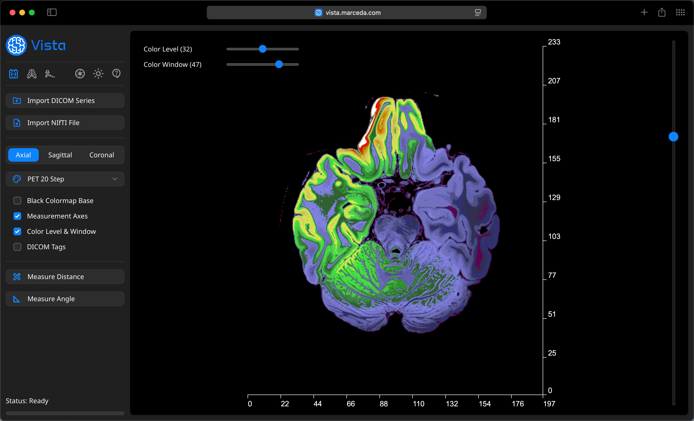 DICOM Viewer Profile on Vista