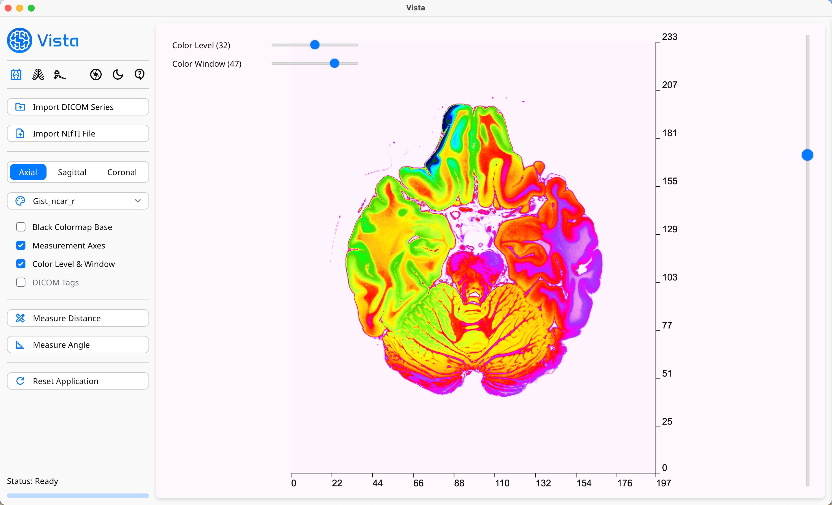 DICOM Viewer Profile on Vista