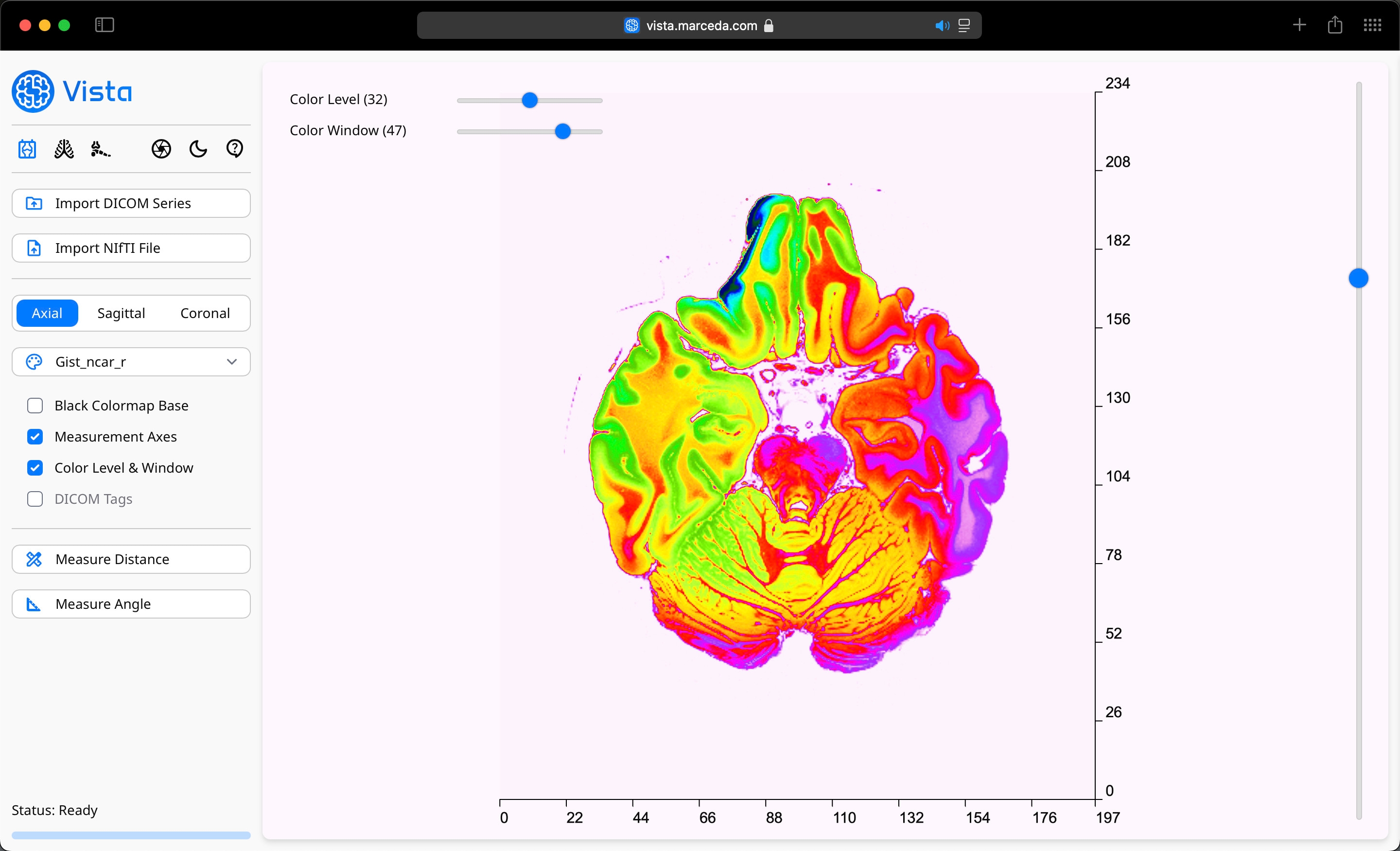 DICOM Viewer Profile on Vista