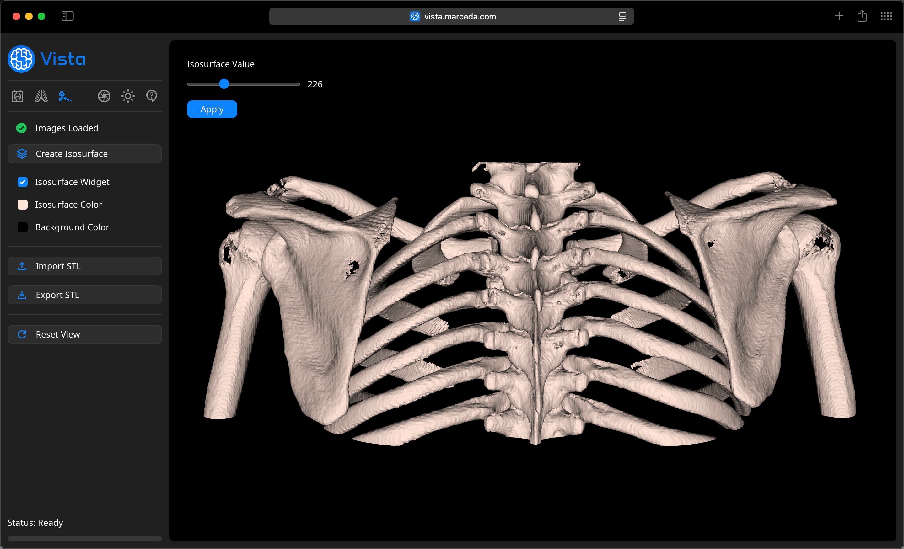 Isosurface Model on Vista