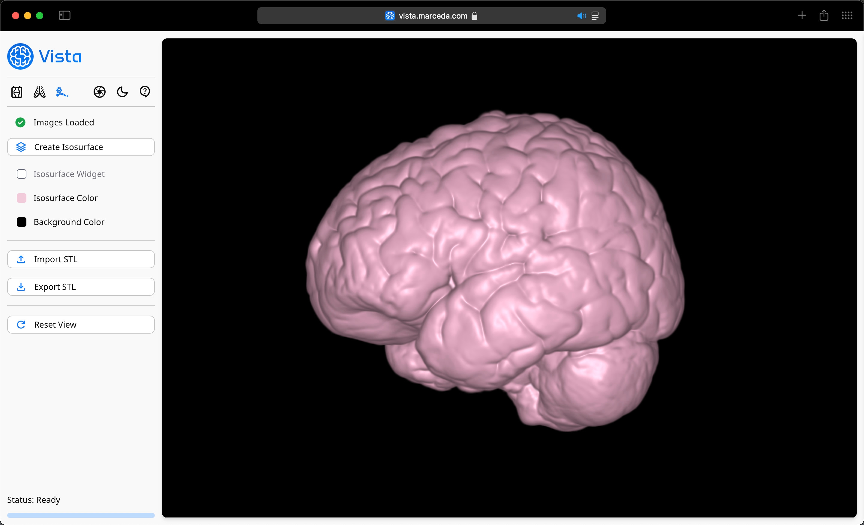 Volume Viewer Profile on Vista