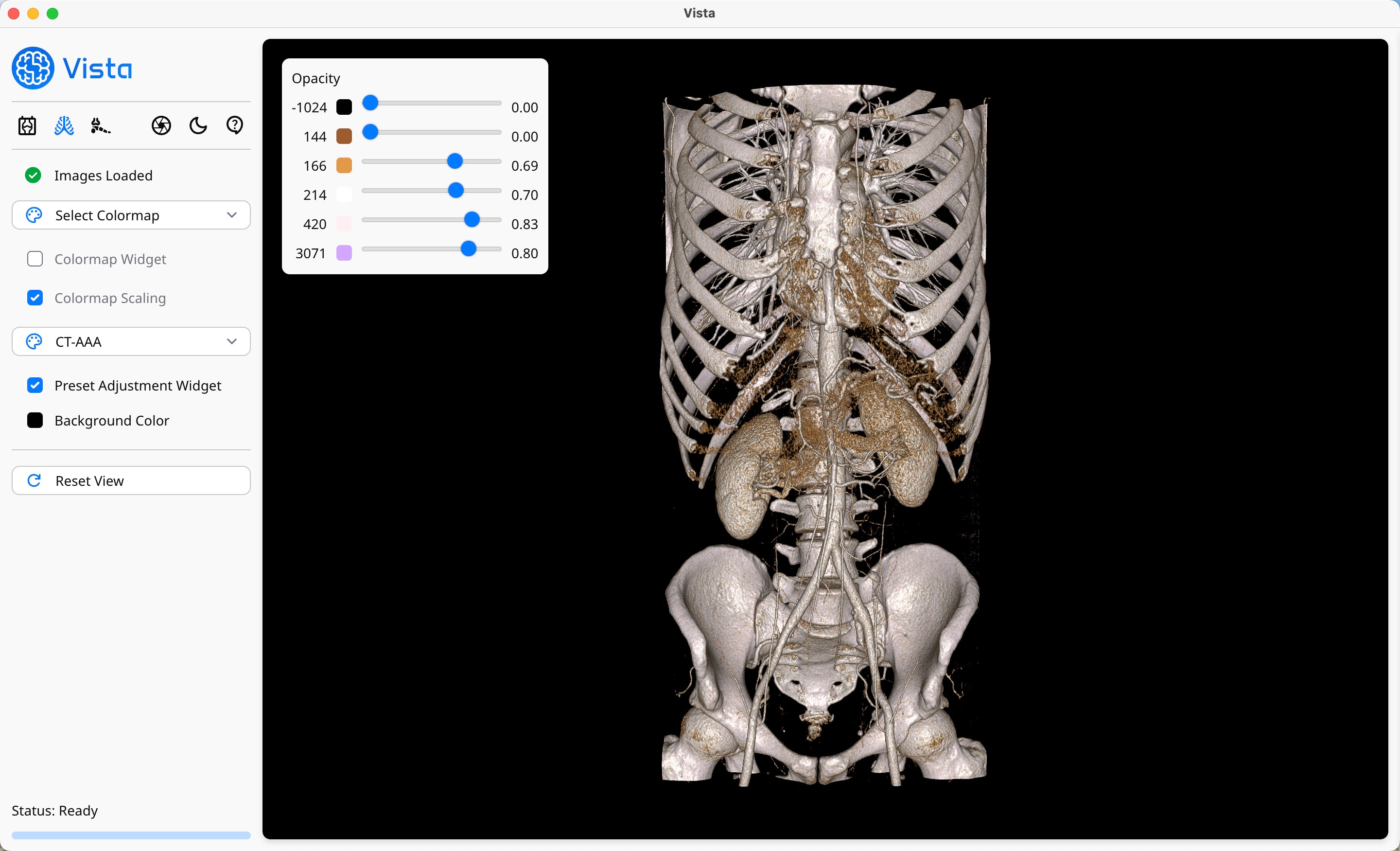 Volume Viewer Profile on Vista - Medical Color Presets