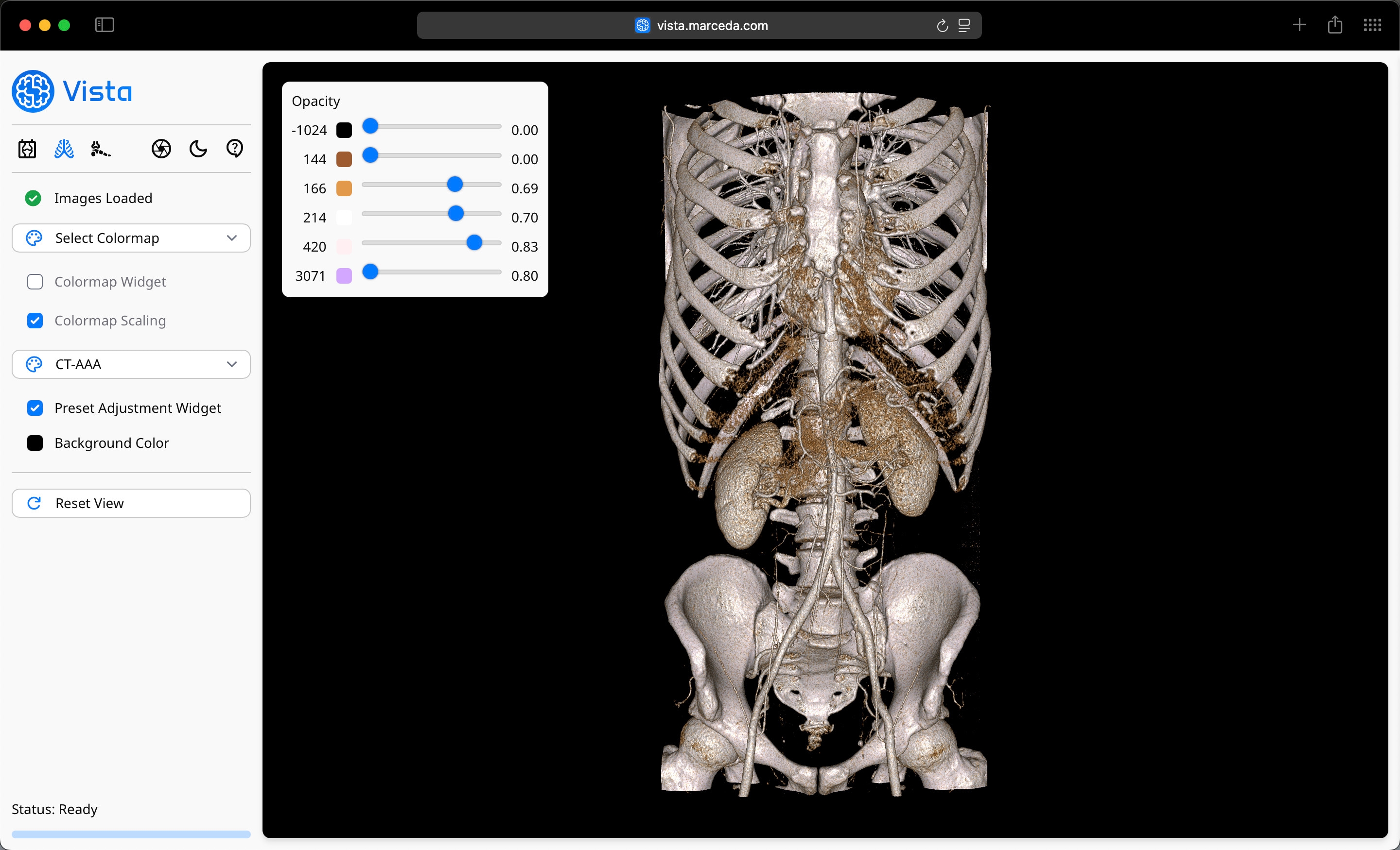 Volume Viewer Profile on Vista - Medical Color Presets