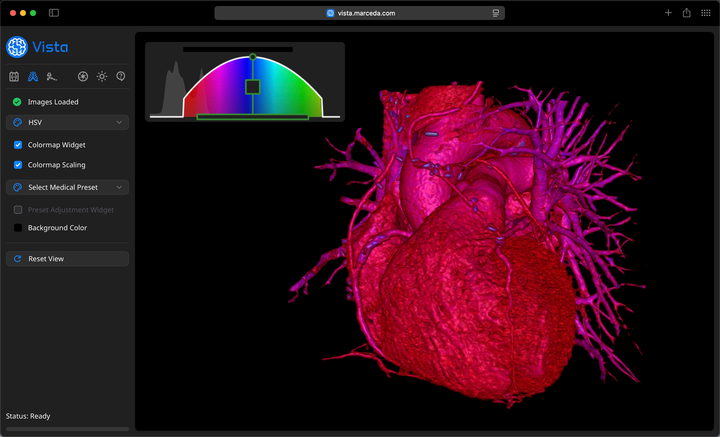 Volume Viewer Profile on Vista - Scientific Colormaps