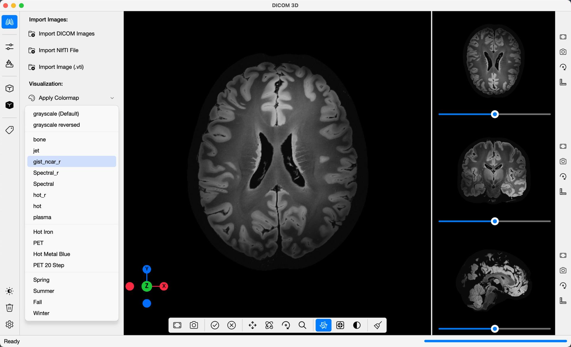 DICOM 3D