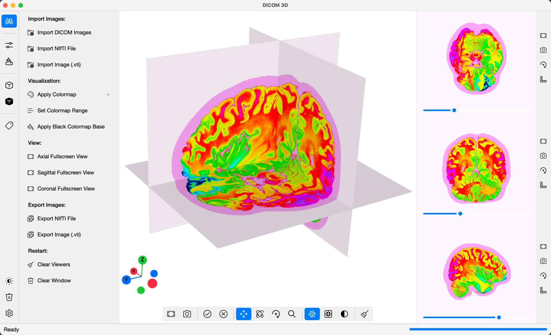 DICOM 3D