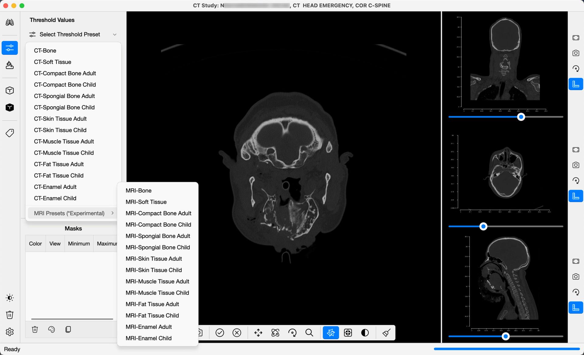 DICOM 3D