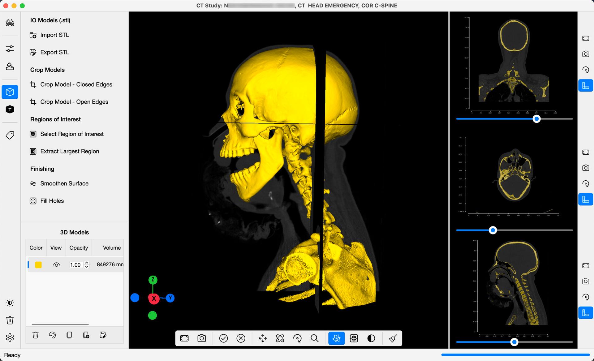 DICOM 3D