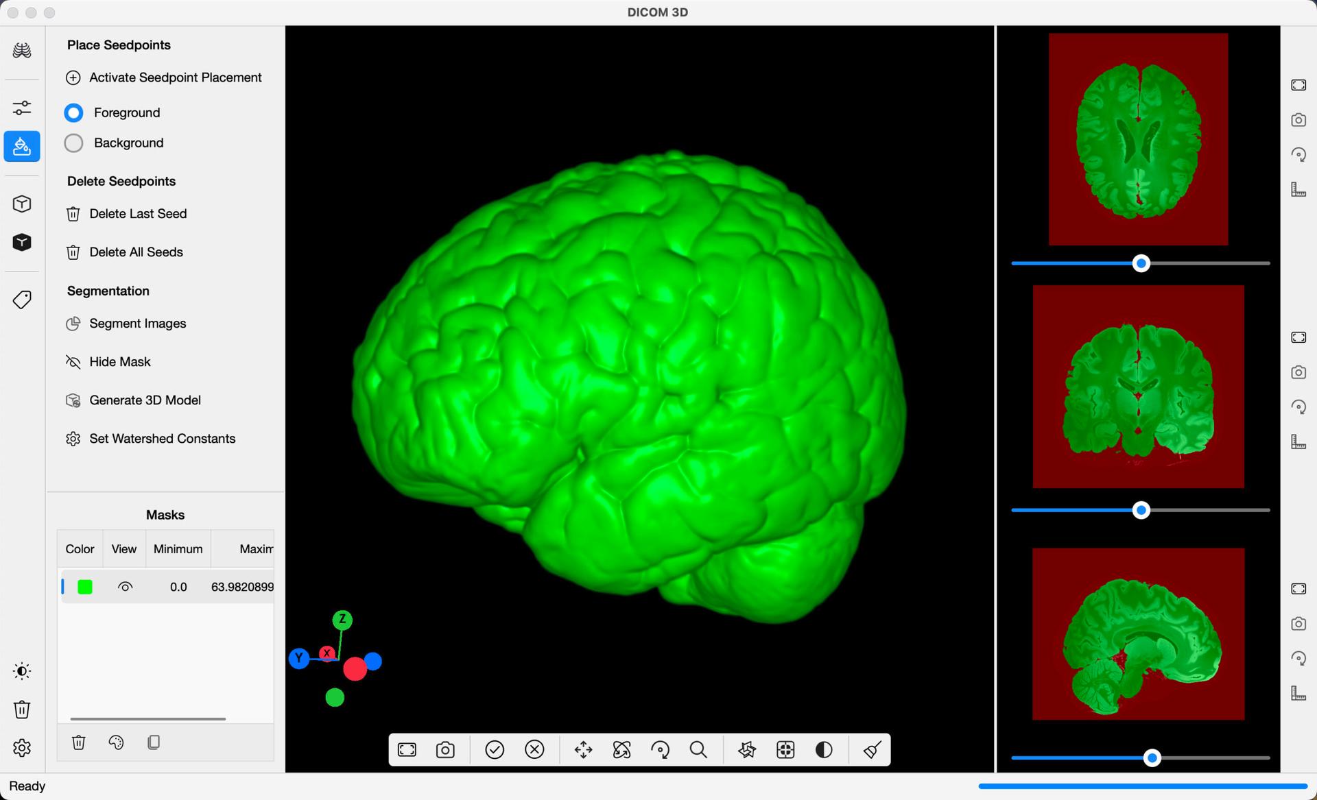 DICOM 3D